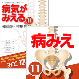 医学生会員限定】病気がみえるvol.11運動器・整形外科（第1版）［書籍