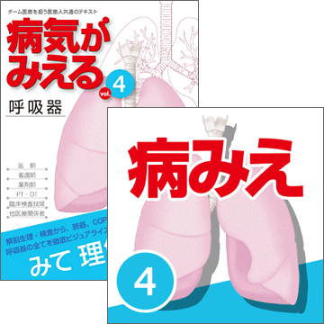【医学生会員限定】病気がみえるvol.4呼吸器（第3版）［書籍＋アプリセット］