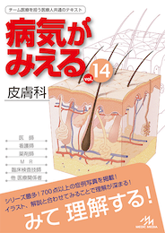 病気がみえるvol.14（書籍版）