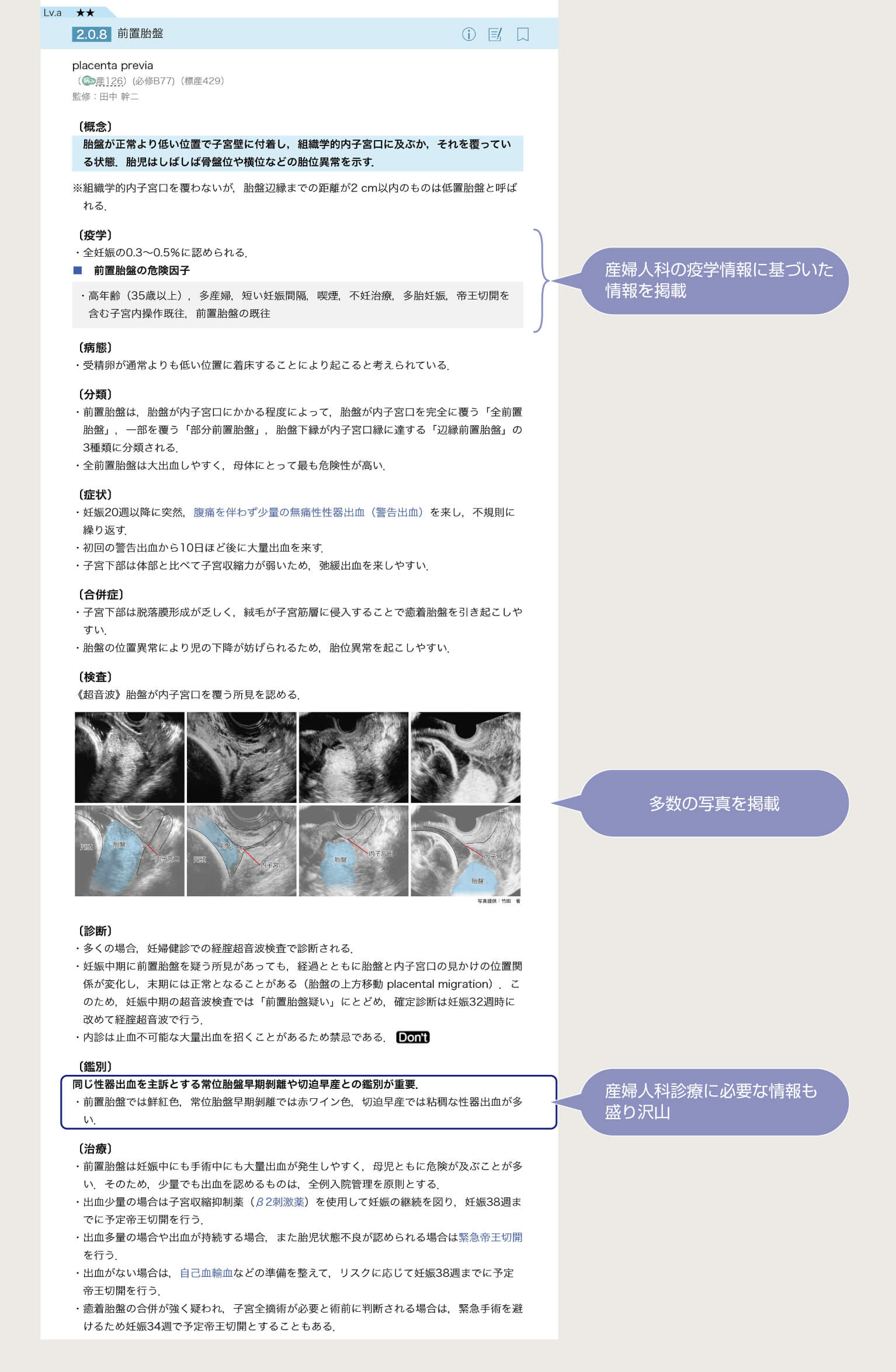 step1
